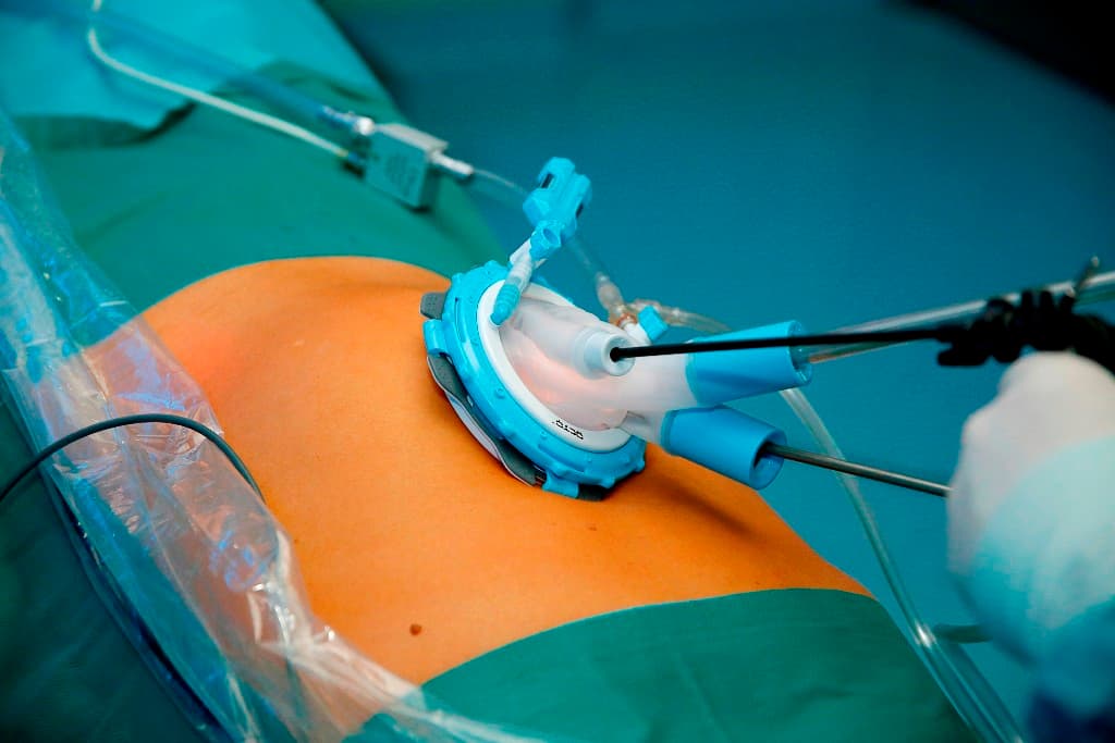 Find Affordable Gastric Sleeve Turkey Price Packages with Expert Surgeons